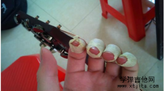 新手彈吉他手指痛的解決方